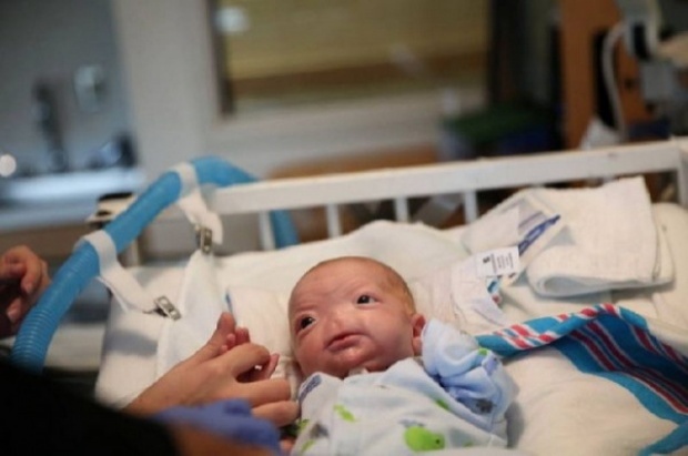 เหลือเชื่อ ทารกมหัศจรรย์ไร้จมูกลืมตาดูโลก โอกาสแค่ 1 ใน 197 ล้านคน แม่ตั้งกองทุนช่วย (ชมภาพ) 