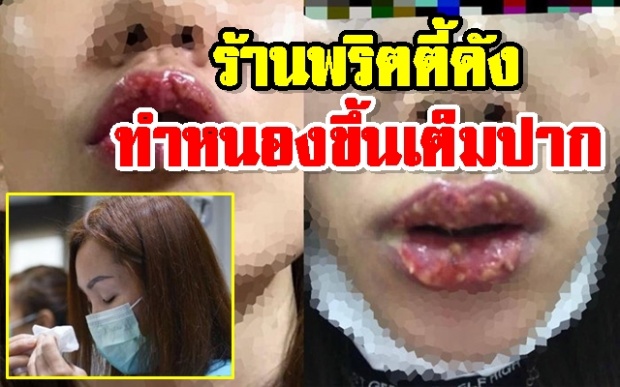 เน่าเฟะ! สาวสักปาก เปิดใจ เห็นเป็นร้าน นิกกี้ พริตตี้คนดังถึงทำ ชี้ไม่รับผิดชอบ