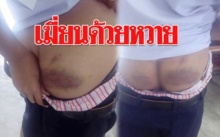 เฆี่ยนด้วยหวาย!! แม่โร่แจ้งความ ลูกชายโดนลงหวายที่ก้นจนไม่สบาย ชี้ทำโทษเกิดกว่าเหตุ!