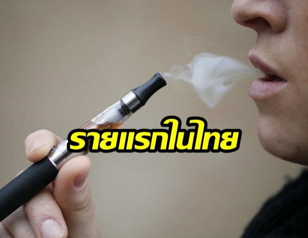 รายแรกของไทย! กรมควบคุมโรคพบผู้ป่วยปอดอักเสบ จากบุหรี่ไฟฟ้า สธ.สั่งเฝ้ารับมือ