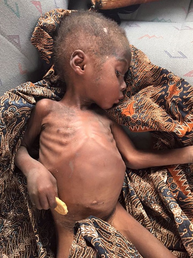 เด็กไนจีเรีย ถูกปล่อยหิวตายในวั้นนั้น ปัจจุบันนี้เปลี่ยนไป ชีวิตดี๊ดี