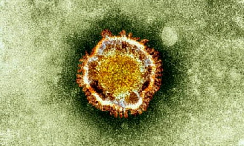 อังกฤษพบผู้ติดเชื้อไวรัสคล้ายซาร์ เสียชีวิตรายแรก