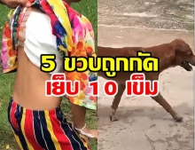 ผวา! เด็ก 5 ขวบถูกสุนัขจรจัดกัด เย็บนับ 10 เข็ม!