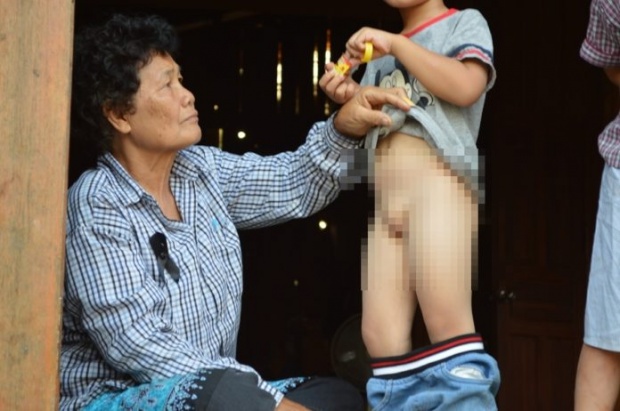 หญิงชาวลาวสามีไทย วอนช่วยลูกเด็กสองเพศไร้สิทธิรักษา หลังสามีตาย!!