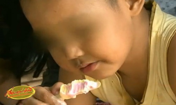 ผู้ปกครองร้องลูกชาย 5 ขวบ ถูกเพื่อนใช้ดินสอทิ่มตาบอด