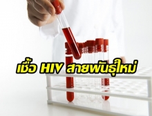 นักวิทยาศาสตร์พบไวรัส “เอชไอวี”ชนิดใหม่