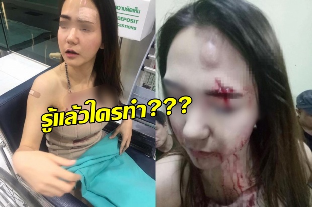 ตร.รู้ตัวแล้วหนุ่มปาแก้วใส่พีอาร์สาวเลือดอาบ เป็นใคร??