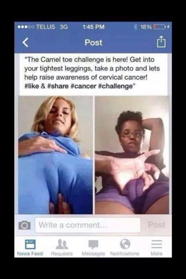 ท้าแบบนี้กล้าทำมั๊ย!? The Camel Toe Challenge รณรงค์ต้านมะเร็งปากมดลูก