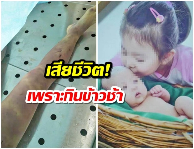 7 ขวบถูกแม่เลี้ยง “ตีดับ” ไม่พอใจปมกินข้าวช้า พ่อก็ถูกซ้อมจนกลัว-ไม่กล้าช่วยลูก