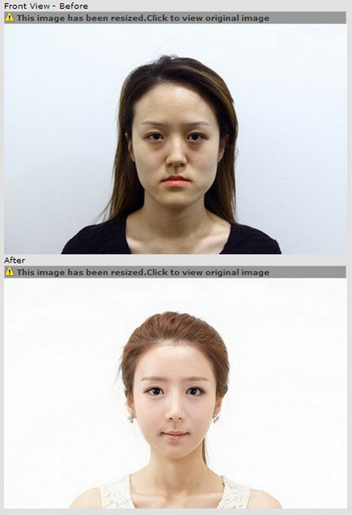 เกาหลีจับพี่น้องฝาแฝดศัลยกรรม พลิกชีวิตจากสาวขี้เหร่สู่เกิร์ลกรุ๊ป