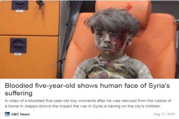 หดหู่!!เด็กซีเรียถูกระเบิด ใบหน้าอาบเลือด นั่งรอการช่วยเหลือด้วยความเศร้า