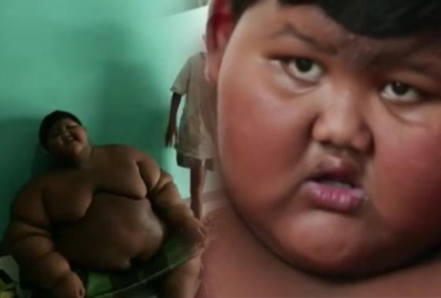 หมอสั่งเด็กชาย 188 กก. ลดน้ำหนักด่วน เพราะอ้วนเขาถึงเป็นแบบนี้