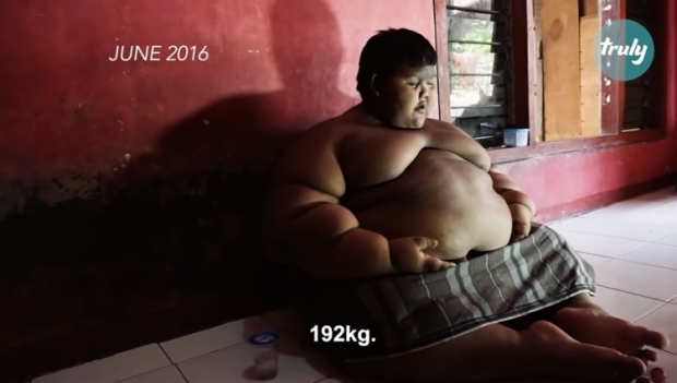 เด็กชายชาวอินโดนีเซียที่อ้วนที่สุดในโลก สามารถลดน้ำหนักออกจนผอมได้สำเร็จ 