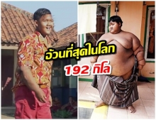 เด็กชายชาวอินโดนีเซียที่อ้วนที่สุดในโลก สามารถลดน้ำหนักออกจนผอมได้สำเร็จ 