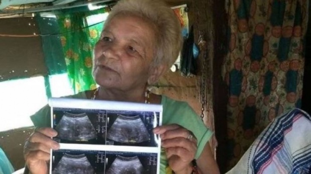 ยายวัย 70 โชว์ผลอัลตราซาวด์ ท้องได้ 6 เดือนแล้ว ทำเอาหมอถึงกับอึ้ง!! (มีคลิป)