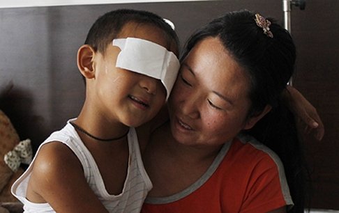 แพทย์จีนเริ่มผ่าตัดรักษาเด็กชายที่ถูกควักลูกตา
