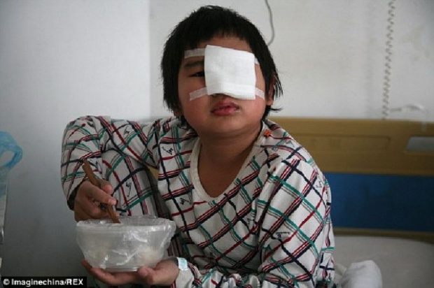 สลด! นักเรียนเคราะห์ร้ายต้องผ่าตัดตา หลังถูกเพื่อนรุมตบหน้า′ตามคำสั่งครู′