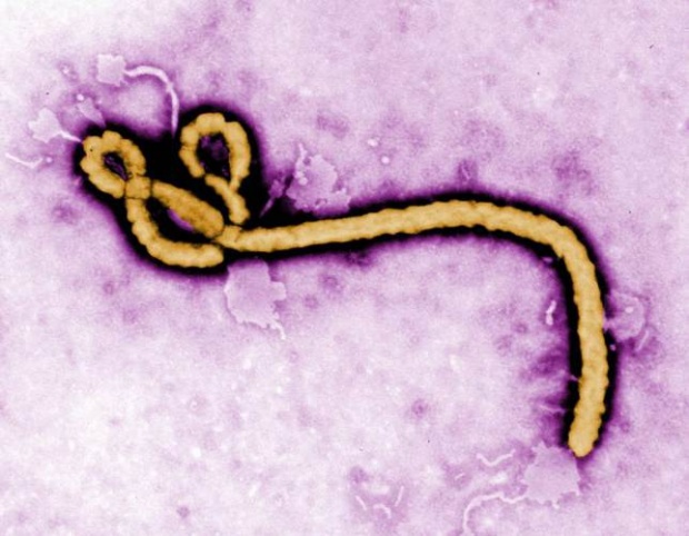 พบผู้ป่วย อีโบลา เสียชีวิตรายแรกในสหรัฐ!!