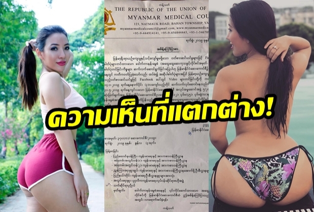 ความเห็นต่าง! แพทย์สาวพม่า  “ถูกถอดใบอนุญาต” เหตุโพสต์ภาพเซ็กซี่ในโซเชียล