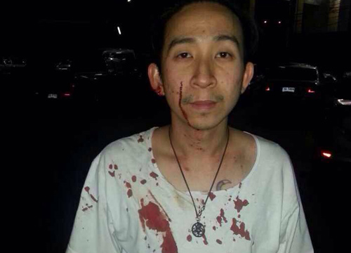 หนุ่ม33ปีถูกยิงกลางสะพานไทย-ญี่ปุ่นเจ็บ