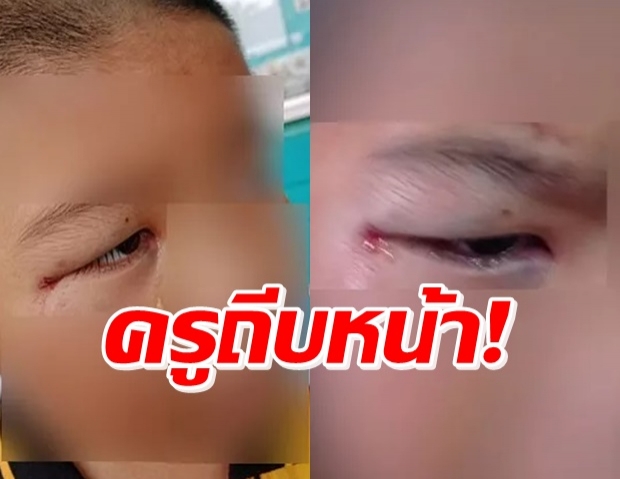  ยาย ร้องปวีณา ครูถีบหน้าหลาน 5 ขวบ ซ้ำให้เพื่อนรุมเตะต่อย