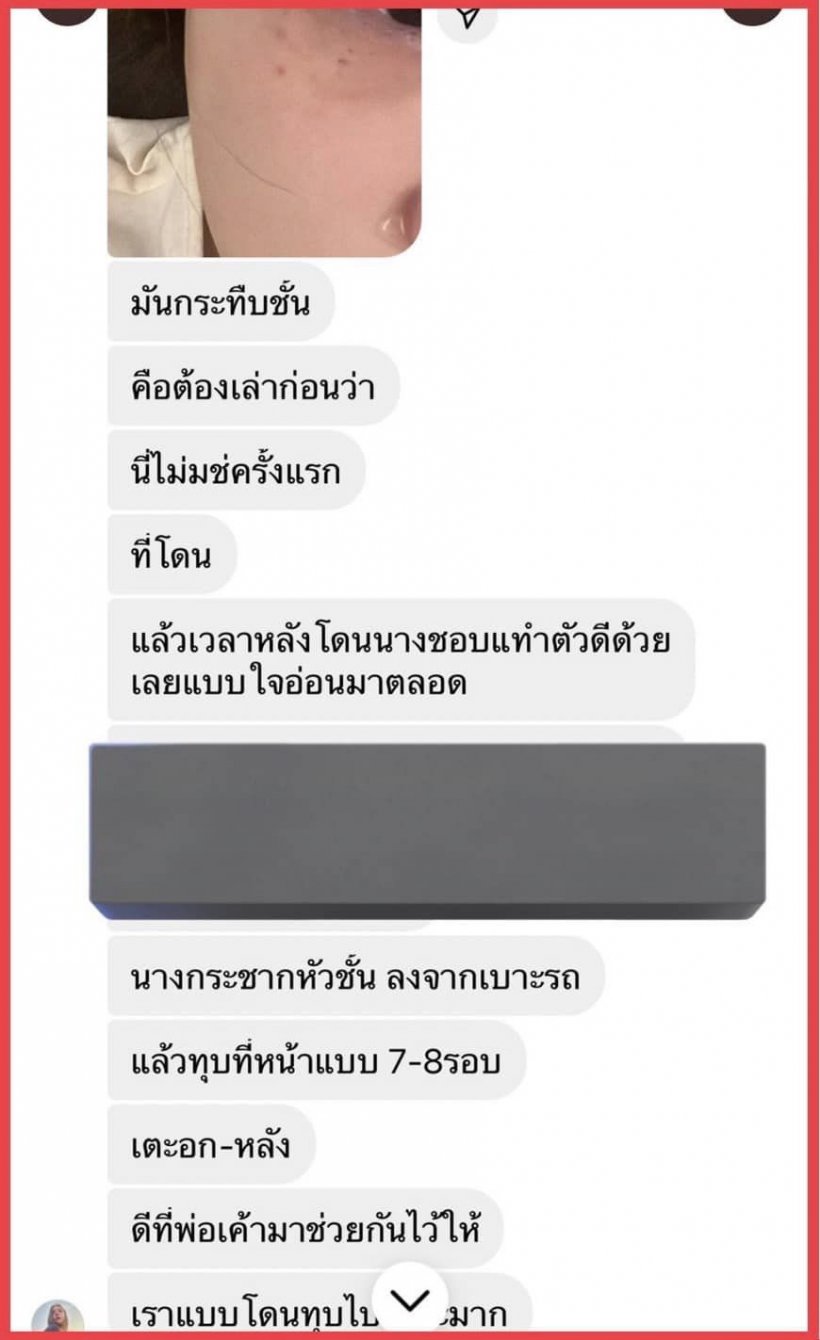 เพื่อนแฉแชท-ภาพ จีจี้ โดนทำร้ายร่างกาย