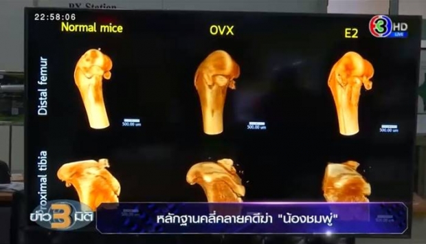 ไขปริศนา วิธีคลี่คลายคดี น้องชมพู่ ด้วยเครื่องมือทันสมัยสุดในเอเชีย