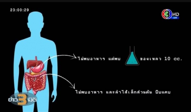 ไขปริศนา วิธีคลี่คลายคดี น้องชมพู่ ด้วยเครื่องมือทันสมัยสุดในเอเชีย