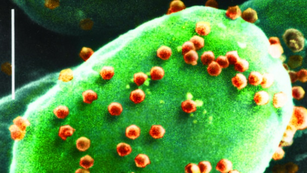 ฮือฮา!! นักวิทย์ฯมะกันพบ ไวรัส ที่ทำให้มนุษย์ โง่กว่าเดิม