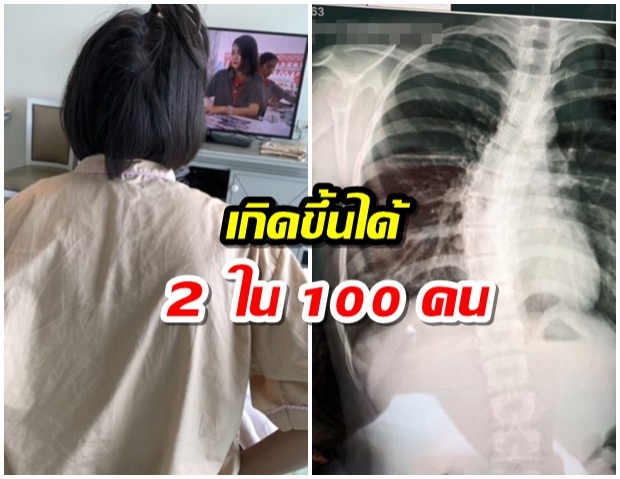 กระเป๋าหนักไม่เกี่ยวกระดูกหลังคด แต่เด็กหญิงมีความเสี่ยง 2 ใน 100 คน