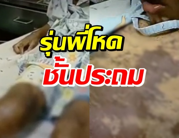 แม่เปิดใจ นาทีบุกรร.พาลูกป.2 ส่งรพ. ถูกรุ่นพี่ทำโทษโหด ดิ้นทุรน