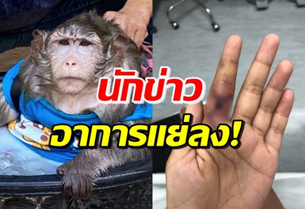 นักข่าวโดน ก็อตซิลลา กัดมือ ถึงขั้นนอนขับถ่ายบนเตียงแล้ว