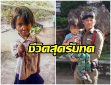 วอนช่วย! เด็ก 4 ขวบแขนพิการ ชีวิตรันทดแม่เสีย-พ่อทิ้ง