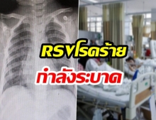 แม่โพสต์เศร้า เสียลูกน้อยวัยเพียง 10 เดือน ด้วยโรคร้าย RSV