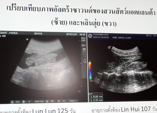 หมอซาวด์หลินฮุ่ยพบตัวอ่อนแต่ไร้สัญญาณชีพอาจแท้ง