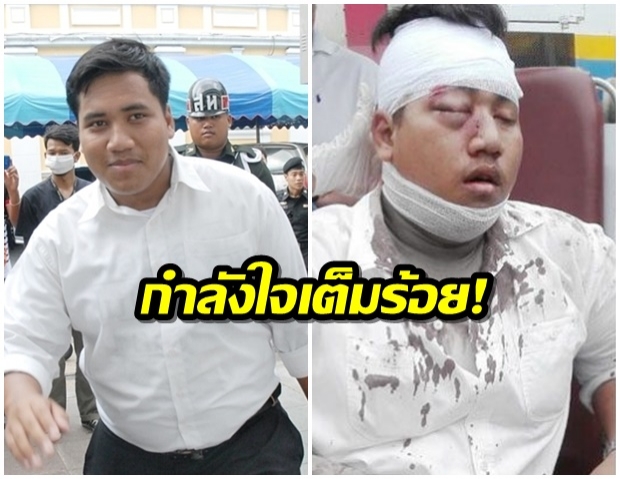 อาจต้องผ่าตัด! “จ่านิว” อาการทรงตัว – แม่ยันกำลังใจเต็มร้อย