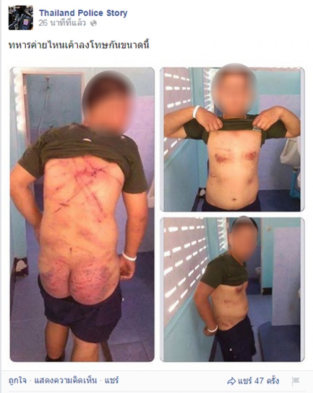 เพจตำรวจแพร่ภาพทหารถูกซ้อม รุมวิพากษ์แตกแยก-เกินกว่าเหตุ 