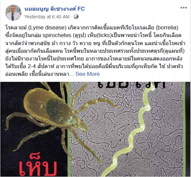 พบผู้ป่วย “โรคลายม์” รายแรกในไทย รักษาหาย แต่จำเหตุการณ์ย้อนหลังไม่ได้