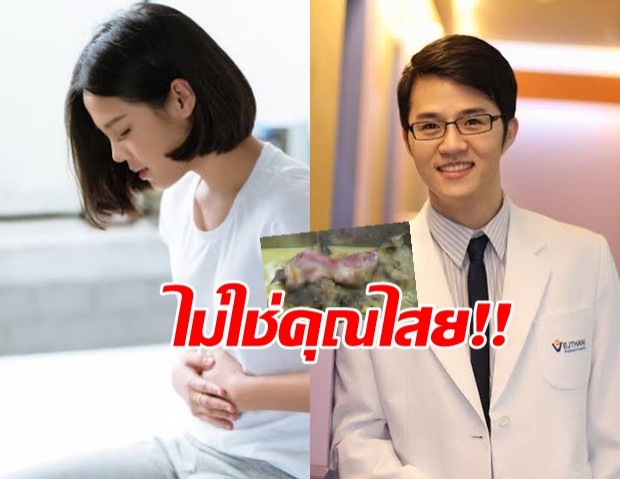 แพทย์ยัน ซีสต์รังไข่ ไม่ใช่คุณไสย หลังพบเศษผม-ฟัน-เล็บข้างใน