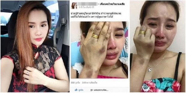 เปิดใจสาวไทยที่โพสต์โชว์แผลบาดเจ็บทั้งตัว หลังทะเลาะกับสามีมาเลย์