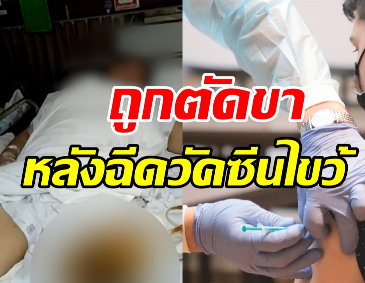 น.ศ.สาวถูกตัดขา1ข้าง ญาติปักใจเพราะฉีดวัคซีนไขว้