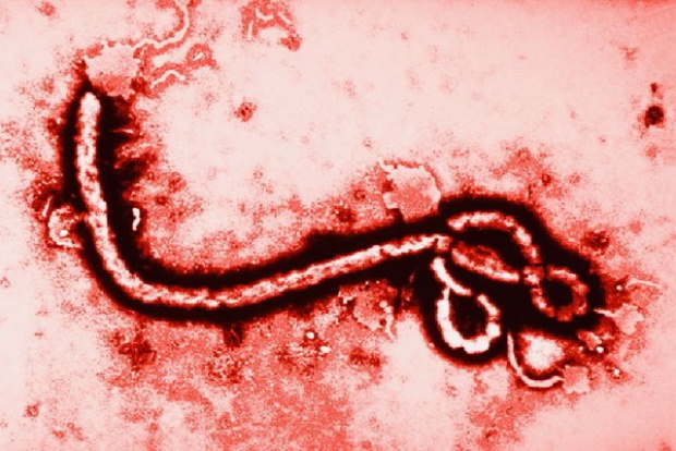 สธ.เผยส่งเลือดให้รพ.จุฬาฯ ตรวจไวรัสอีโบลาหญิงวัย 48 ปีซ้ำอีกรอบ