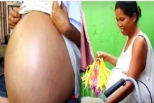 คดีพลิก!!อึ้งหนักแพทย์ยันเองปมสาวท้อง 2 ปี  แท้จริงไม่ได้ท้องแต่เป็นแบบนี้!!
