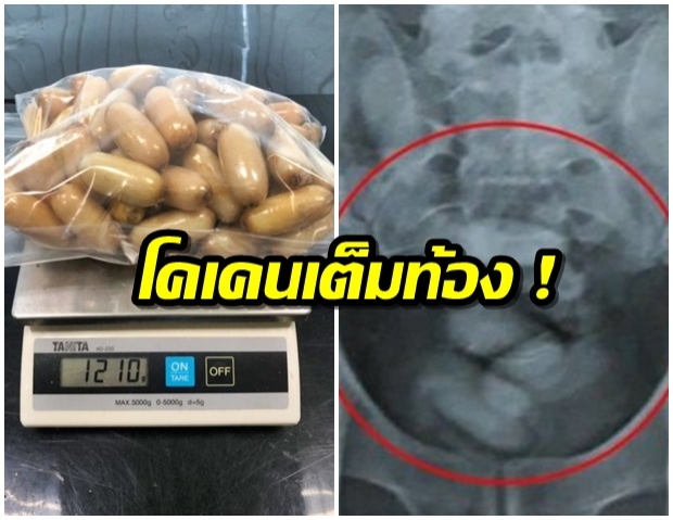 รวบคาสุวรรณภูมิ! ชายเคนย่า กลืนโคเคน 68 ก้อน ค่า 3.6 ล้าน ตบตาจนท.เข้าไทย