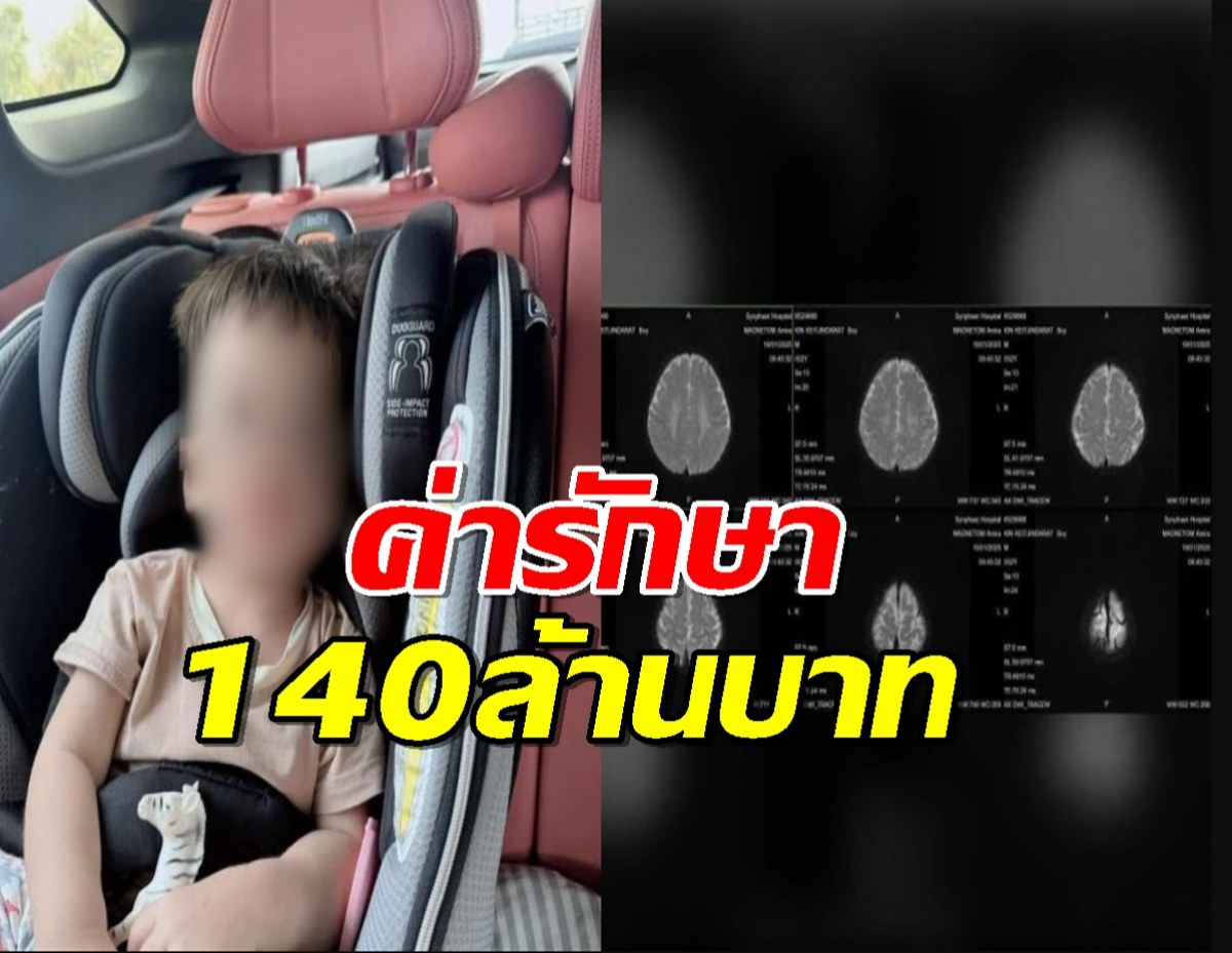 สธ.ยื่นมือช่วย น้องเดย์ตั้น เด็กน้อยป่วยโรคหายาก ค่ารักษา140ล้าน!