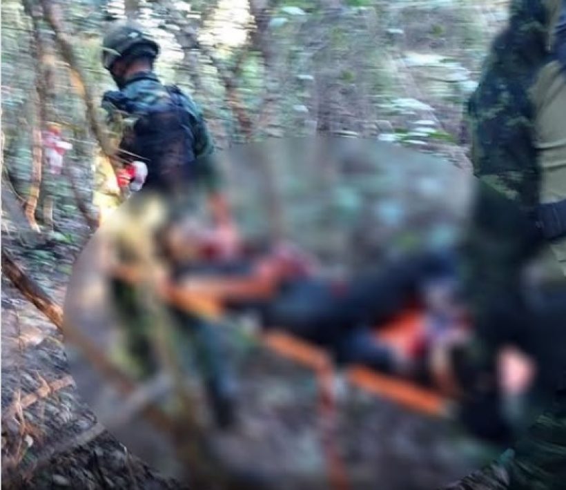 เปิดผลตรวจทุ่นระเบิด ชาวจีนเหยียบขาขาด ชายแดนบ้านหนองจาน