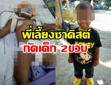  พ่อ-แม่เศร้า!! ลูก2ขวบ ถูกพี่เลี้ยงซาดิสต์กัดทุบตีจนก้านสมองตาย