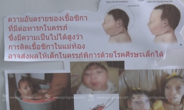 สธ.เผย! 2 ทารกศีรษะเล็กเกิดจาก “ซิกา” พบเป็นครั้งแรกในไทย
