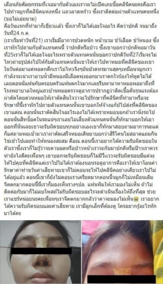 เสริมจมูกเน่า! ซิลิโคนทำพิษเสริมดั้ง ตา-หน้าบวม ติดเชื้อรุนแรง ผ่าตัดด่วน คลินิกปิดเงียบ