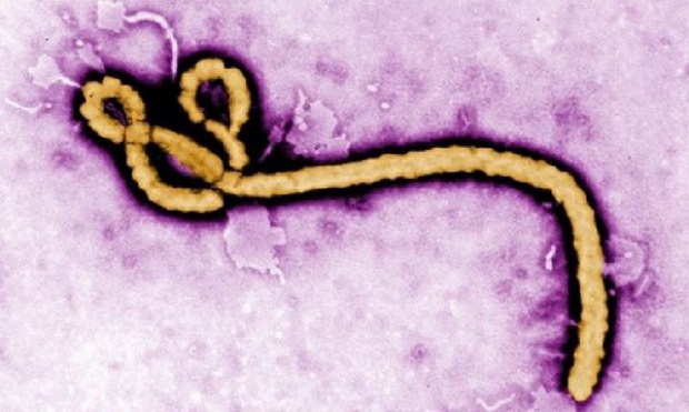 ศิริราชสั่งซื้อเครื่องตรวจหาไวรัสอีโบลา